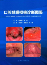 口腔黏膜损害诊断图鉴