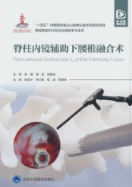 脊柱内镜辅助下腰椎融合术