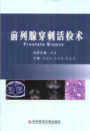 前列腺穿刺活检术