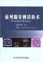 前列腺穿刺活检术