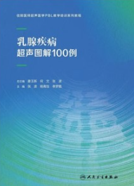 乳腺疾病超声图解100例
