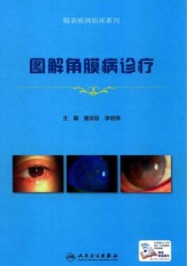 图解角膜病诊疗