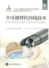 全可视脊柱内镜技术