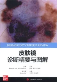 皮肤镜诊断精要与图解