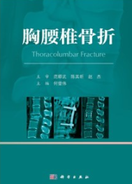 胸腰椎骨折