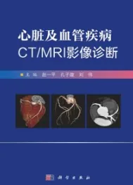 心脏及血管疾病CT MRI影像诊断