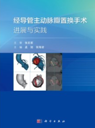 经导管主动脉瓣置换手术进展与实践