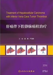 肝癌伴下腔静脉癌栓治疗