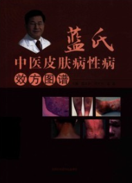 蓝氏中医治疗皮肤病性病效方图谱