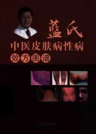 蓝氏中医治疗皮肤病性病效方图谱
