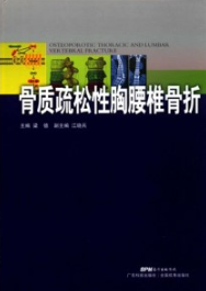 骨质疏松性胸腰椎骨折