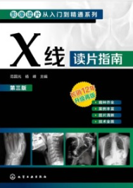 X线读片指南（第三版）