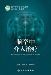 脑卒中介入治疗