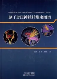 脑干DTI神经纤维束图谱