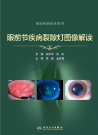 眼前节疾病裂隙灯图像解读