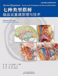 七种类型搭桥 脑血运重建原理与技术