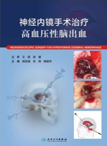 神经内镜手术治疗高血压性脑出血