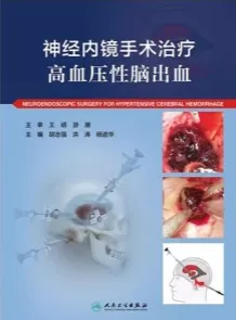 神经内镜手术治疗高血压性脑出血