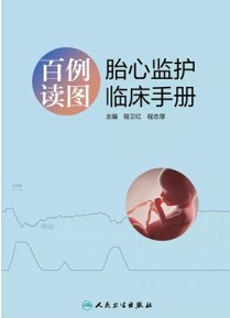 百例读图 胎心监护临床手册
