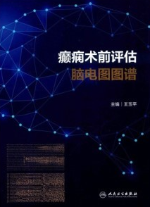 癫痫术前评估脑电图图谱