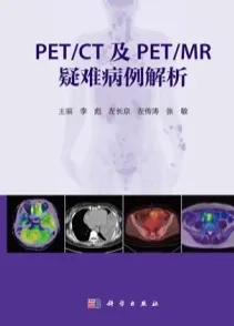 PET_CT及PET_MR疑难病例解析