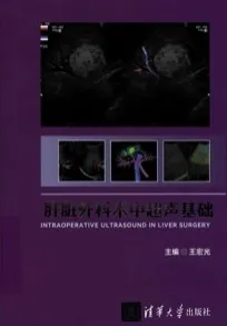 肝脏外科术中超声基础