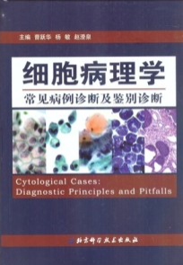 细胞病理学常见病例诊断及鉴别诊断