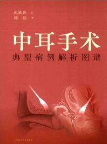 中耳手术典型病例解析图谱