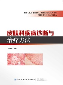 皮肤科疾病诊断与治疗方法