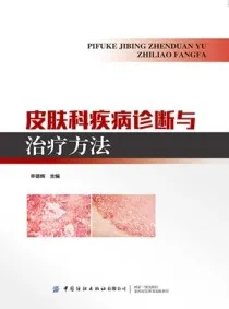 皮肤科疾病诊断与治疗方法