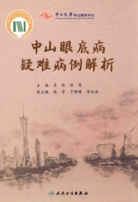 中山眼底病疑难病例解析