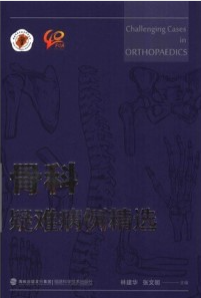 骨科疑难病例精选
