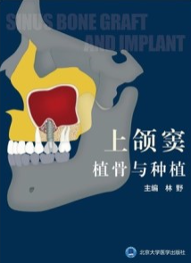 上颌窦植骨与种植