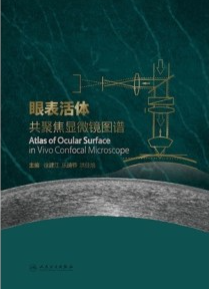 眼表活体共聚焦显微镜图谱