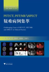 PET_CT, PET_MR 与SPECT 疑难病例集萃