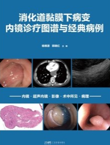 消化道黏膜下病变内镜诊疗图谱与经典病例