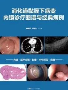 消化道黏膜下病变内镜诊疗图谱与经典病例