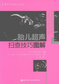 胎儿超声扫查技巧图解