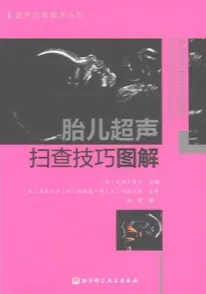 胎儿超声扫查技巧图解