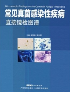 常见真菌感染性疾病直接镜检图谱