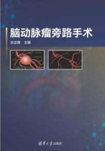 脑动脉瘤旁路手术