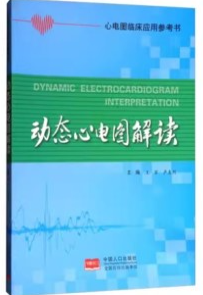 动态心电图解读
