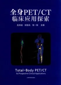 全身PET_CT临床应用探索