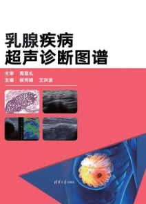 乳腺疾病超声诊断图谱