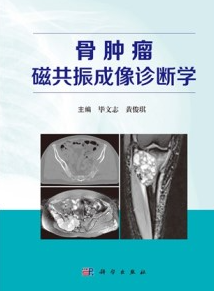 骨肿瘤磁共振成像诊断学