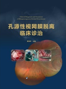 孔源性视网膜脱离临床诊治