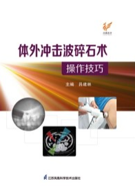 体外冲击波碎石术操作技巧