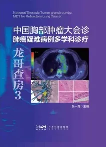 中国胸部肿瘤大会诊 肺癌疑难病例多学科诊疗