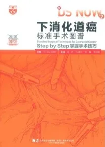 下消化道癌标准手术图谱