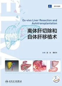 离体肝切除和自体肝移植术